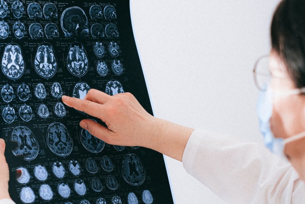 imagini cdt bratianu pitesti servicii medicale neurologie