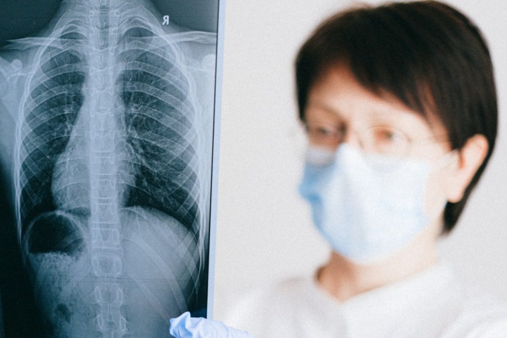 imagini cdt bratianu pitesti servicii medicale pneumologie